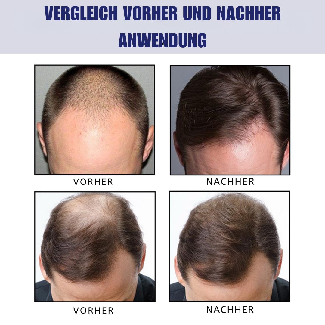 Men's Dense Hair Foam Machine, Repair Hair Root Follicle Men's Hair Thick Moisturizing Foam