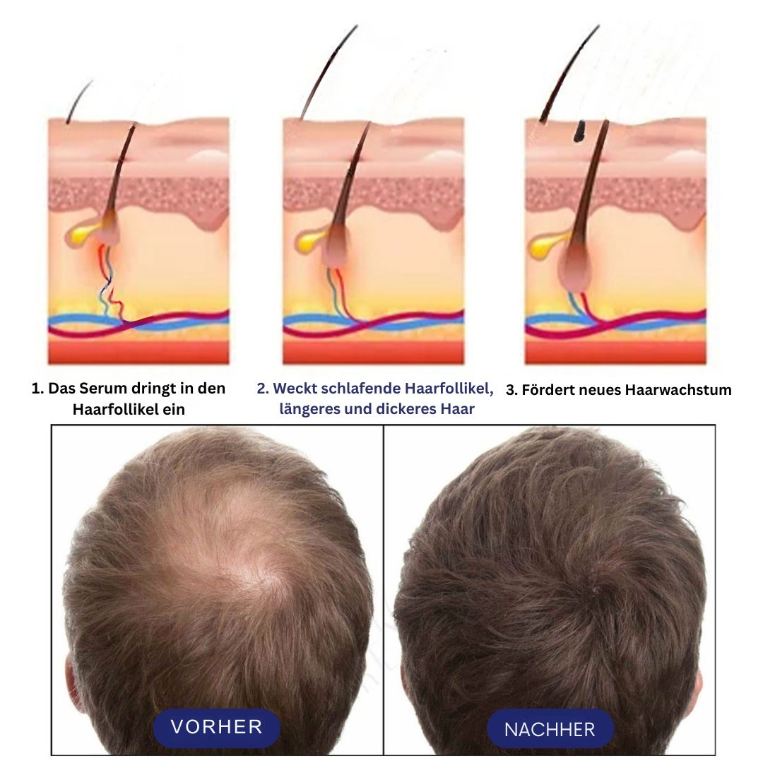 Men's Dense Hair Foam Machine, Repair Hair Root Follicle Men's Hair Thick Moisturizing Foam