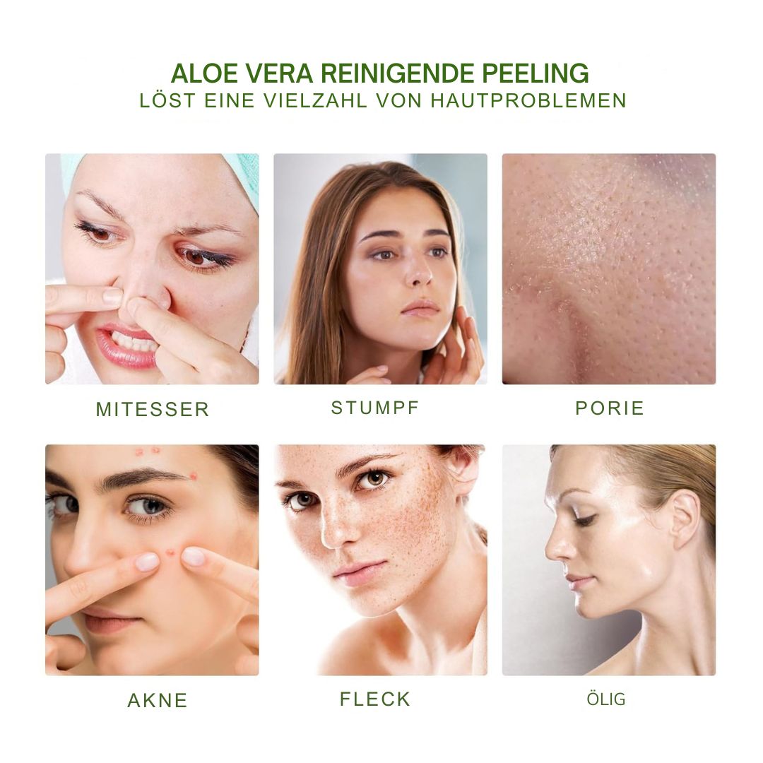 Aloe Vera Scrub For Deep Cleansing, Exfoliating And Smoothing Acne Marks, Soft Skin Scrub