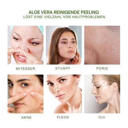 Aloe Vera Scrub For Deep Cleansing, Exfoliating And Smoothing Acne Marks, Soft Skin Scrub